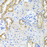 Immunohistochemistry of paraffin-embedded Rat kidney using STRN3 Polyclonal Antibody at dilution of 1:100 (40x lens) .