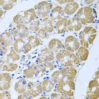 Immunohistochemistry of paraffin-embedded Human stomach using STRN3 Polyclonal Antibody at dilution of 1:100 (40x lens) .