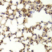 Immunohistochemistry of paraffin-embedded Mouse lung using TAF1C Polyclonal Antibody at dilution of 1:100 (40x lens) .