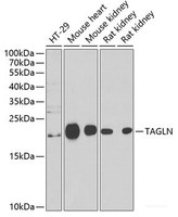 Western blot analysis of extracts of various cell lines using TAGLN Polyclonal Antibody at dilution of 1:1000.