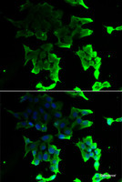 Immunofluorescence analysis of HeLa cells using TANK Polyclonal Antibody