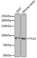 Western blot analysis of extracts of various cell lines using TLK2 Polyclonal Antibody at dilution of 1:1000.