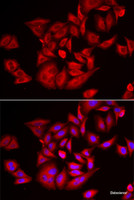Immunofluorescence analysis of U2OS cells using TLK2 Polyclonal Antibody