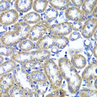 Immunohistochemistry of paraffin-embedded Rat kidney using TMED10 Polyclonal Antibody at dilution of 1:100 (40x lens) .