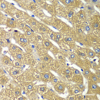 Immunohistochemistry of paraffin-embedded Human liver damage using TMED10 Polyclonal Antibody at dilution of 1:100 (40x lens) .