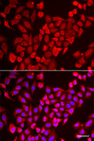 Immunofluorescence analysis of U2OS cells using TNP2 Polyclonal Antibody