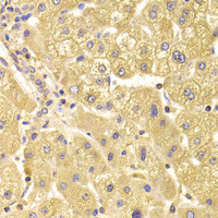 Immunohistochemistry of paraffin-embedded Human liver damage using TRAF3IP2 Polyclonal Antibody at dilution of 1:100 (40x lens) .
