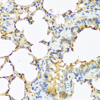 Immunohistochemistry of paraffin-embedded Mouse lung using TSHB Polyclonal Antibody at dilution of 1:100 (40x lens) .