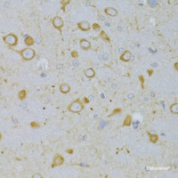 Immunohistochemistry of paraffin-embedded Rat brain using TSHR Polyclonal Antibody at dilution of 1:100 (40x lens) .