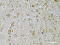 Immunohistochemistry of paraffin-embedded Mouse brain using TSHR Polyclonal Antibody at dilution of 1:100 (40x lens) .