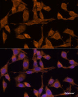 Immunofluorescence analysis of HeLa cells using USP15 Polyclonal Antibody at dilution of 1:100 (40x lens) . Blue: DAPI for nuclear staining.