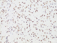 Immunohistochemistry of paraffin-embedded Rat brain using Bcl9 Polyclonal Antibody at dilution of 1:100 (20x lens) .