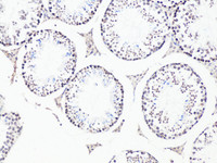 Immunohistochemistry of paraffin-embedded Mouse testis using Bcl9 Polyclonal Antibody at dilution of 1:100 (20x lens) .