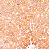 Immunohistochemistry of paraffin-embedded Rat liver using CPT1B Polyclonal Antibody at dilution of 1:100 (40x lens) .