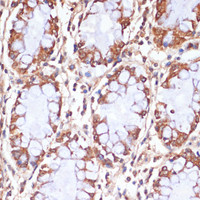 Immunohistochemistry of paraffin-embedded Human colon using CPT1B Polyclonal Antibody at dilution of 1:100 (40x lens) .