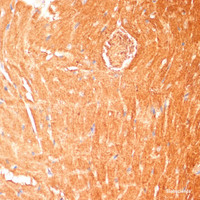 Immunohistochemistry of paraffin-embedded Mouse heart using CPT1B Polyclonal Antibody at dilution of 1:100 (40x lens) .