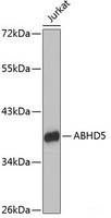 Western blot analysis of extracts of Jurkat cells using ABHD5 Polyclonal Antibody.