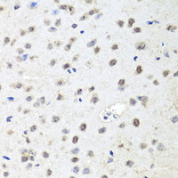 Immunohistochemistry of paraffin-embedded Mouse brain using Argonaute-2 Polyclonal Antibody at dilution of 1:100 (40x lens) .