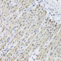 Immunohistochemistry of paraffin-embedded Mouse stomach using FANCL Polyclonal Antibody at dilution of 1:100 (40x lens) .