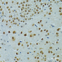 Immunohistochemistry of paraffin-embedded Mouse brain using MUS81 Polyclonal Antibody at dilution of 1:100 (40x lens) .