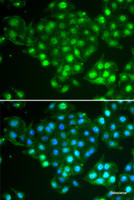 Immunofluorescence analysis of HeLa cells using ABCA3 Polyclonal Antibody