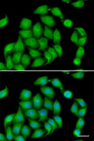 Immunofluorescence analysis of HeLa cells using ASPH Polyclonal Antibody