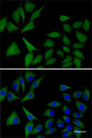 Immunofluorescence analysis of MCF7 cells using ATOX1 Polyclonal Antibody