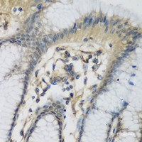 Immunohistochemistry of paraffin-embedded Human stomach using C1S Polyclonal Antibody at dilution of 1:200 (40x lens) .