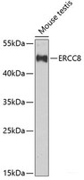 Western blot analysis of extracts of Mouse testis using ERCC8 Polyclonal Antibody at dilution of 1:1000.