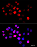 Immunofluorescence analysis of HeLa cells using CYP4B1 Polyclonal Antibody at dilution of 1:100 (40x lens) . Blue: DAPI for nuclear staining.