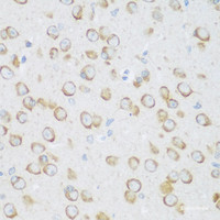 Immunohistochemistry of paraffin-embedded Mouse brain using DHODH Polyclonal Antibody at dilution of 1:100 (40x lens) .