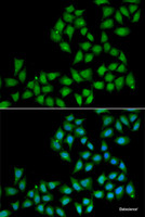 Immunofluorescence analysis of A549 cells using ELF1 Polyclonal Antibody