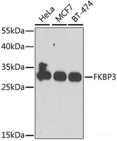 Western blot analysis of extracts of various cell lines using FKBP3 Polyclonal Antibody at dilution of 1:1000.