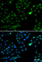 Immunofluorescence analysis of HeLa cells using FKBP3 Polyclonal Antibody
