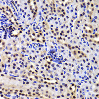 Immunohistochemistry of paraffin-embedded Mouse kidney using GABPB1 Polyclonal Antibody at dilution of 1:100 (40x lens) .