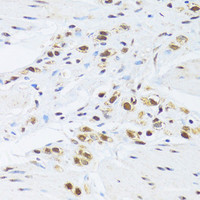 Immunohistochemistry of paraffin-embedded Human stomach using GABPB1 Polyclonal Antibody at dilution of 1:100 (40x lens) .