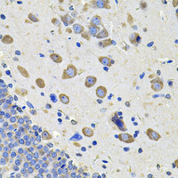 Immunohistochemistry of paraffin-embedded Rat brain using GALNT2 Polyclonal Antibody at dilution of 1:100 (40x lens) .