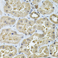 Immunohistochemistry of paraffin-embedded Human kidney using GALNT2 Polyclonal Antibody at dilution of 1:100 (40x lens) .
