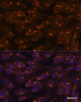 Immunofluorescence analysis of C6 cells using GALNT2 Polyclonal Antibody at dilution of 1:100. Blue: DAPI for nuclear staining.