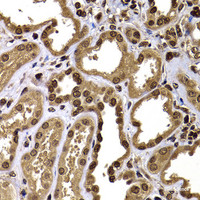 Immunohistochemistry of paraffin-embedded Human kidney using GPS1 Polyclonal Antibody at dilution of 1:100 (40x lens) .