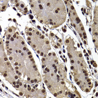 Immunohistochemistry of paraffin-embedded Human stomach using GPS1 Polyclonal Antibody at dilution of 1:100 (40x lens) .