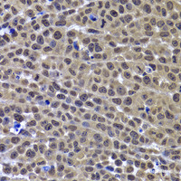 Immunohistochemistry of paraffin-embedded Mouse cancer using GPS1 Polyclonal Antibody at dilution of 1:100 (40x lens) .