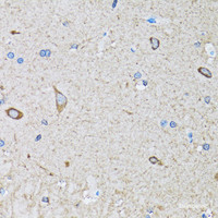 Immunohistochemistry of paraffin-embedded Mouse brain using HIP1 Polyclonal Antibody at dilution of 1:100 (40x lens) .