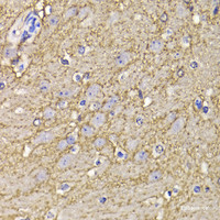 Immunohistochemistry of paraffin-embedded Mouse brain using KCND3 Polyclonal Antibody at dilution of 1:100 (40x lens) .