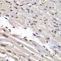 Immunohistochemistry of paraffin-embedded Mouse heart using HNRNPM Polyclonal Antibody at dilution of 1:100 (40x lens) .