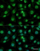 Immunofluorescence analysis of L929 cells using HNRNPM Polyclonal Antibody at dilution of 1:100. Blue: DAPI for nuclear staining.