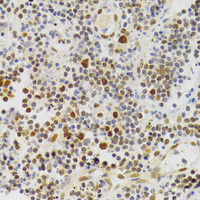 Immunohistochemistry of paraffin-embedded Human appendicitis using NASP Polyclonal Antibody at dilution of 1:100 (40x lens) .
