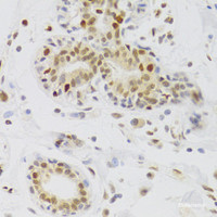 Immunohistochemistry of paraffin-embedded Human breast using NASP Polyclonal Antibody at dilution of 1:100 (40x lens) .