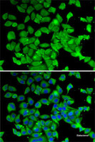 Immunofluorescence analysis of MCF7 cells using PARN Polyclonal Antibody