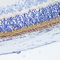 Immunohistochemistry of paraffin-embedded Rat retina using PDE6B Polyclonal Antibody at dilution of 1:200 (40x lens) .